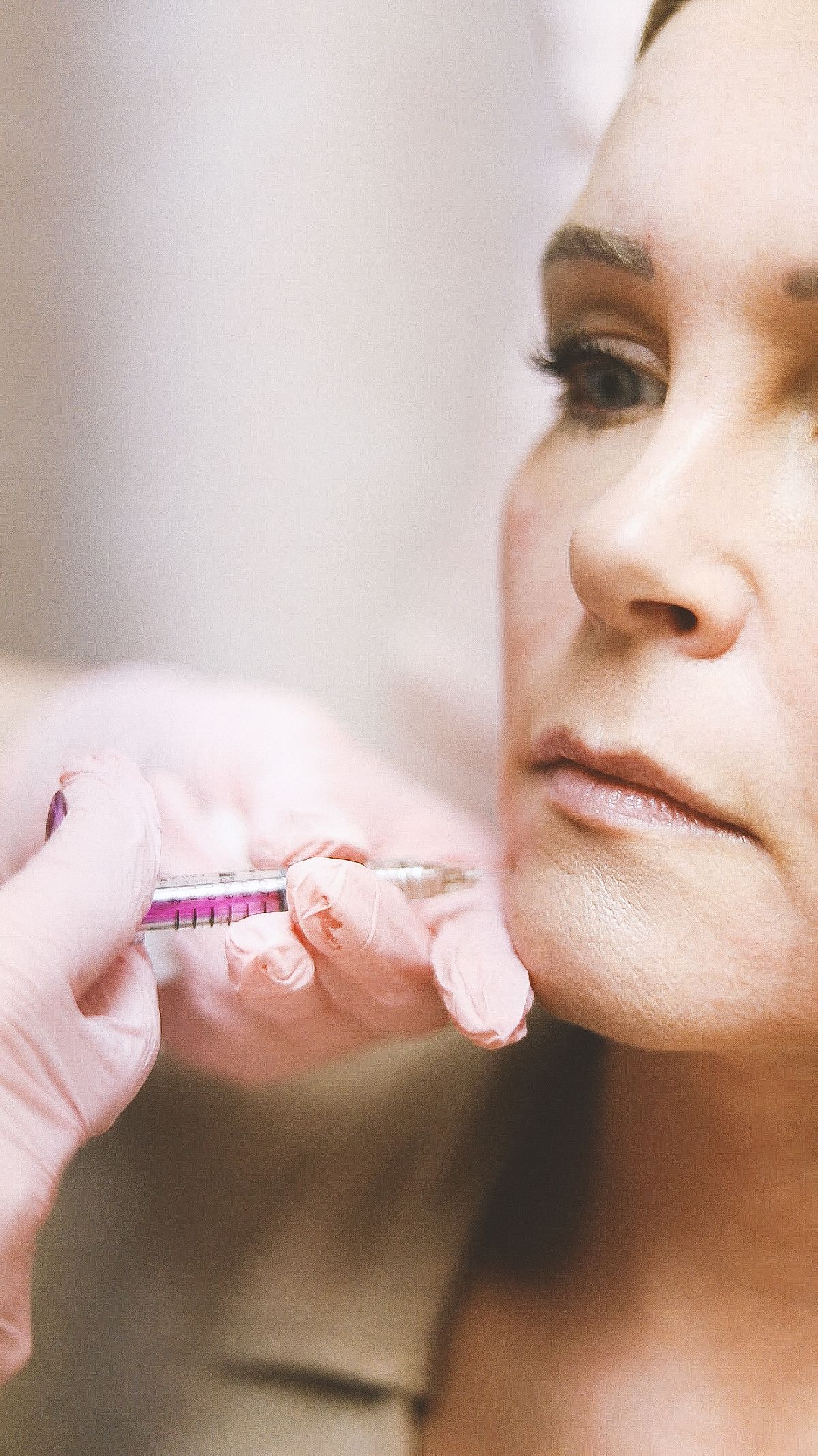 Dermal Fillers at Godiva Medspa